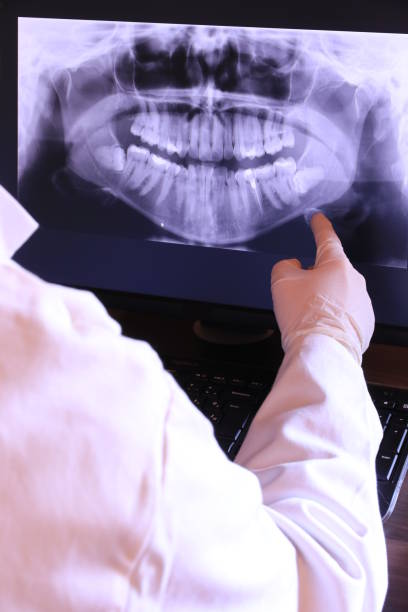 Best Emergency Treatment for Dental Infections or Abscesses in Glencoe, MN